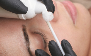 Gestion des réactions allergiques: comment réagir face à cette situation de manière professionnelle?