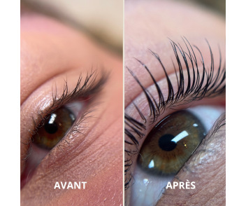 Précommande Kit K-Lift