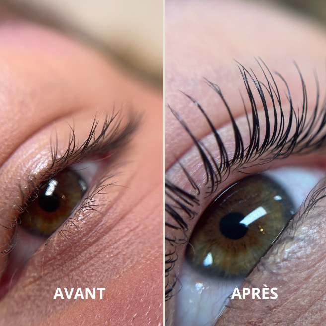 Précommande Kit K-Lift